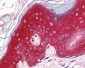 PAK4 Antibody (Internal)